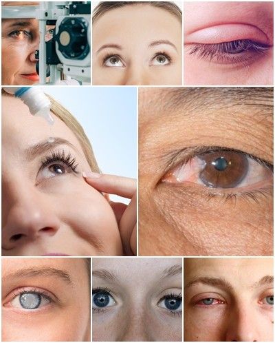 Who Needs Low Vision Management