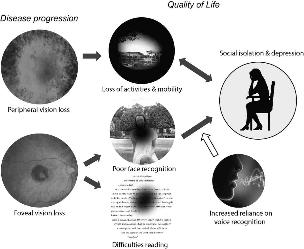 Risks of Ignoring Low Vision