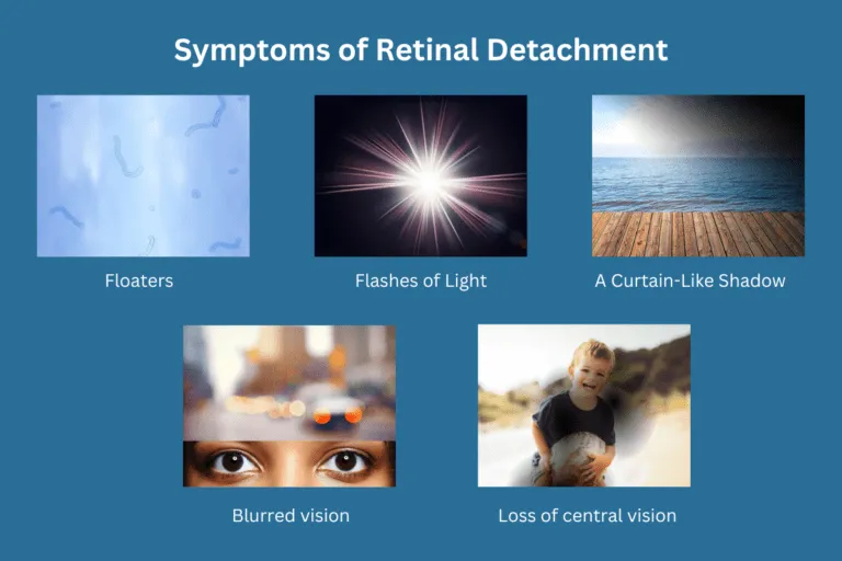 Symptoms of Retinal Diseases