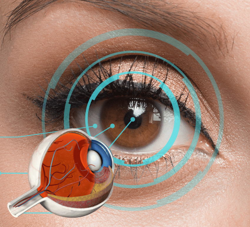 Types of Retinal Conditions