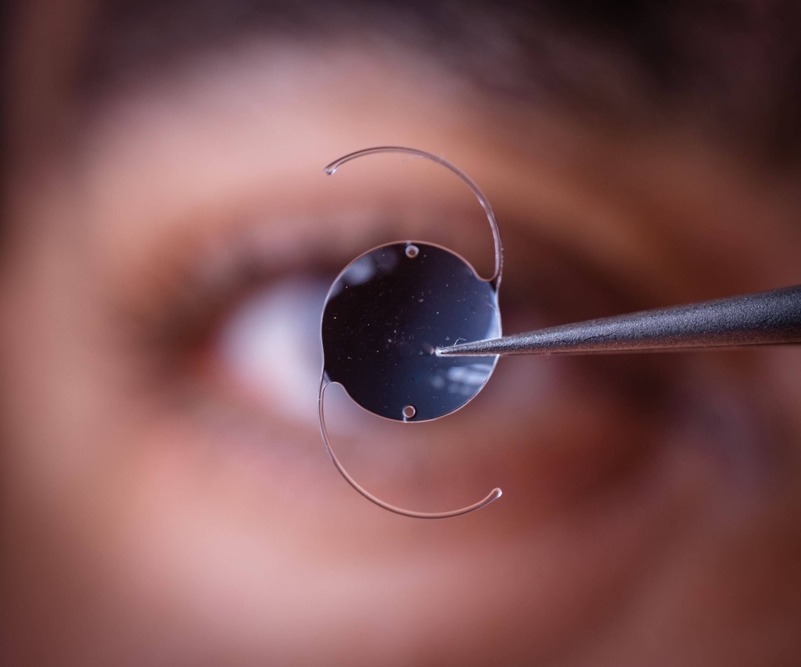 ICL Surgery